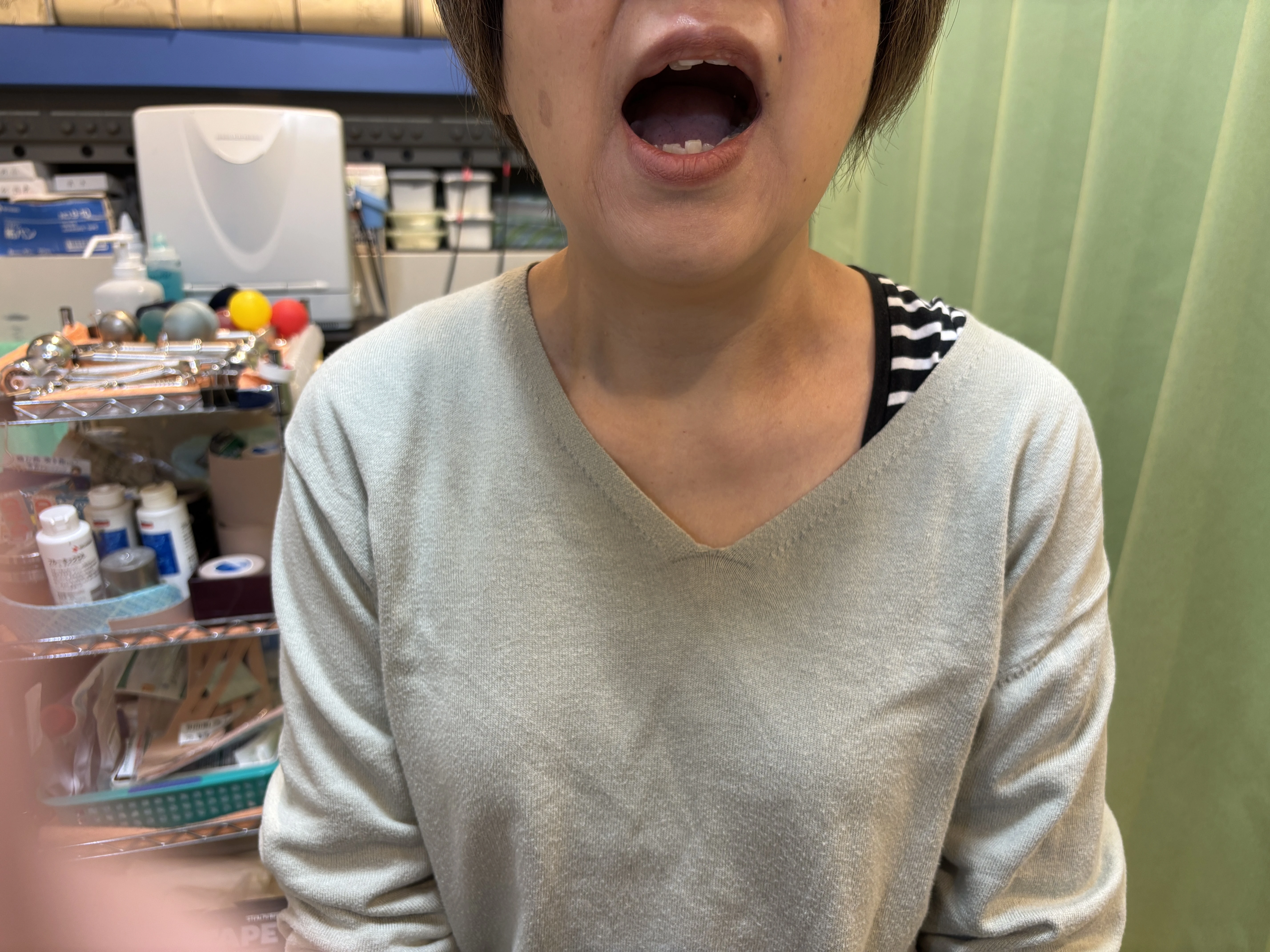 ダウンロード (7)